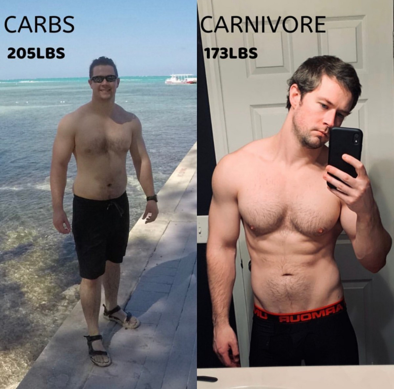 Carnivore Diet Results: Before and After Pictures - Dr. Robert Kiltz